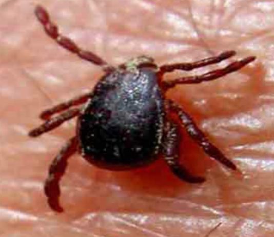 Congo virus patient Salman Shinwari dies in Rawalpindi hospital