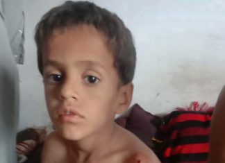 Children injured in mortar attack